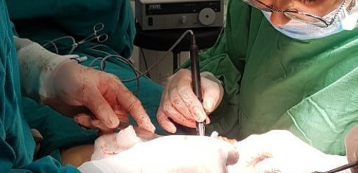 Ангиомикрохирурги Педиатрического университета рассказали о сложнейших операциях