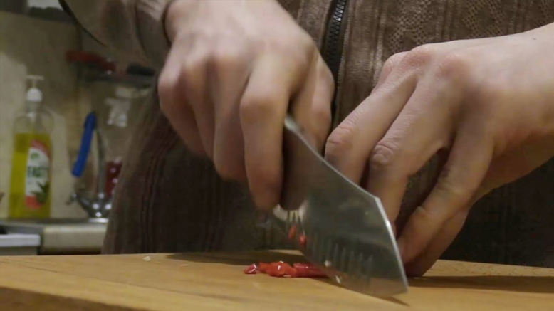 Микрохирурги Педиатрического университета восстановили палец 17-летнему подростку