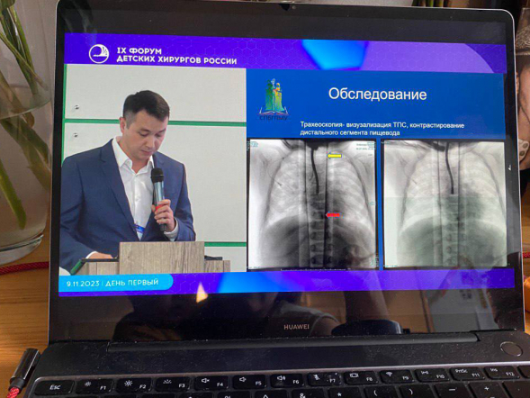 Врачи Педиатрического университета приняли участие в конгрессе детских хирургов