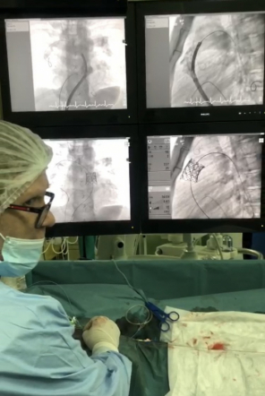 Врачи Педиатрического университета выполнили рентгенэндоваскулярную имплантацию клапана лёгочной артерии 14-летнему пациенту из Луганска 9